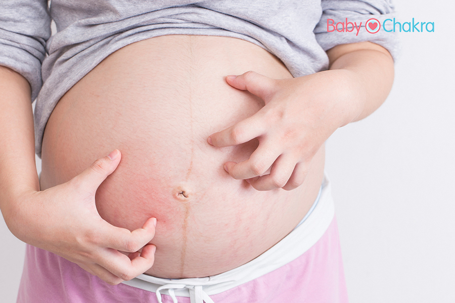 Here’s Why The Body Feels Itchy During Pregnancy?
