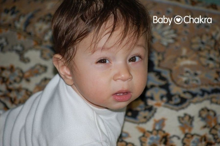 शिशु की आंखों में सूजन के कारण और इलाज