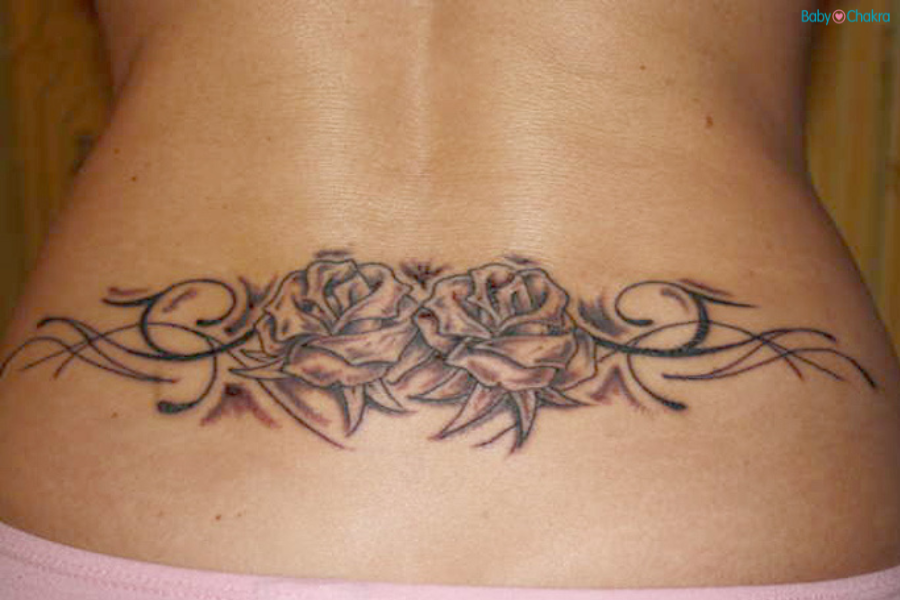 Can You Have An Epidural If You Have A Lower Back Tattoo?